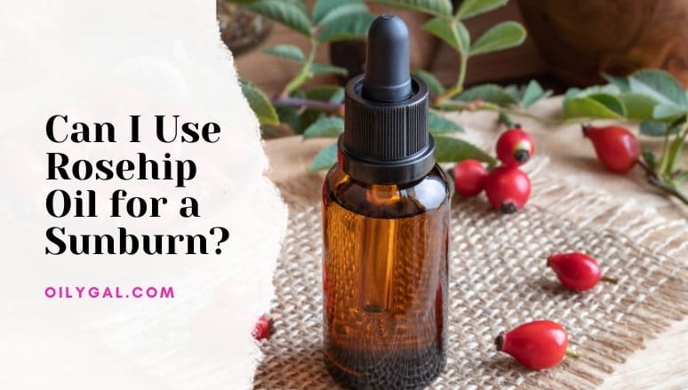 Can I Use Rosehip Oil for a Sunburn