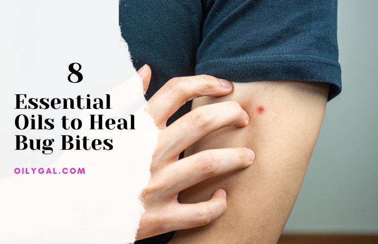 Essential Oils to Heal Bug Bites