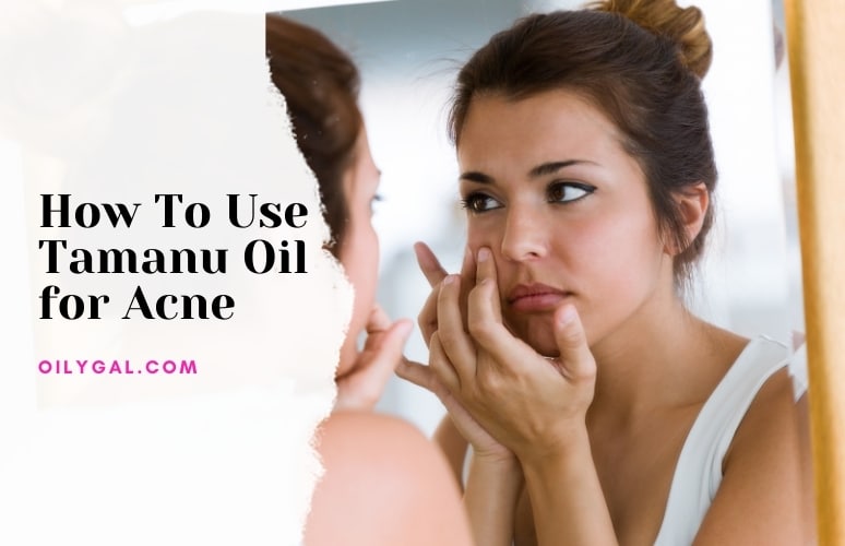 How To Use Tamanu Oil for Acne