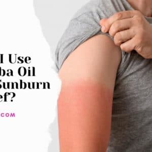 Can I Use Jojoba Oil for Sunburn Relief?
