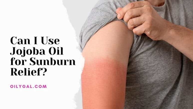 Can I Use Jojoba Oil for Sunburn Relief?